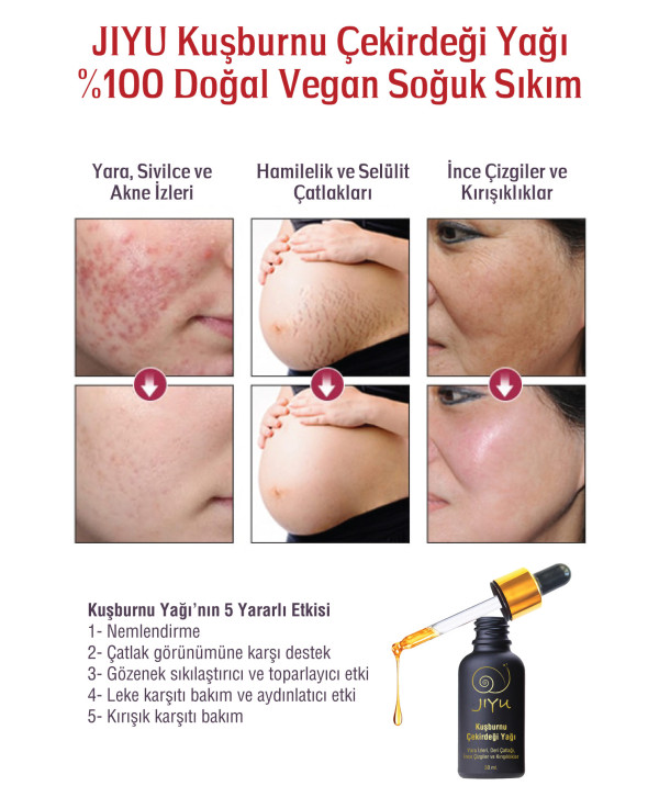 Jiyu Kuşburnu Çekirdeği Yağı %100 Doğal Vegan Soğuk Sıkım 30 ml.